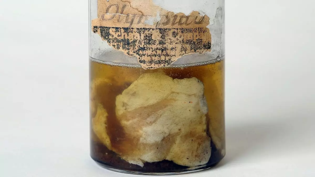 1876'da Kentucky’e Yağmur Gibi Yağan Gizemli Çiğ Et Parçaları: Bilim Dünyasını Hâlâ Şaşırtan Olay 59 image 42